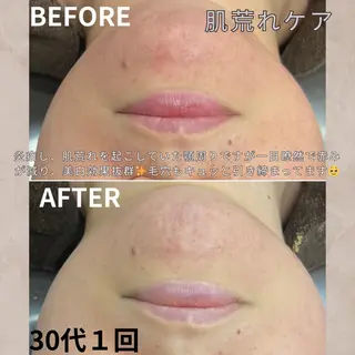 大橋 唯のエステ・リラクイメージ