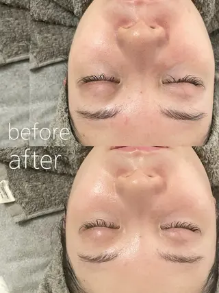 LBSホワイトニング 🌐岡山店のその他イメージ