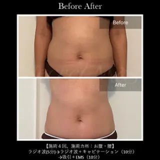 伊藤 正美のマツエク・マツパデザイン