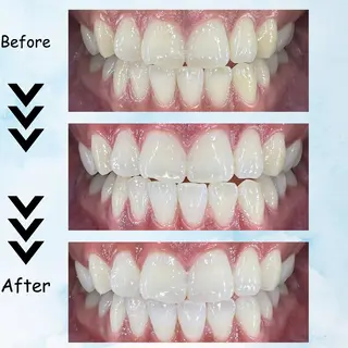 カラー セルフホワイトニング エクシア塩釜口駅前店所属・セルフホワイトニング エクシア塩釜口駅前店のその他イメージ