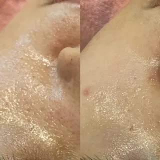 痩身•小顔•ツヤ肌 810神戸元町店のエステ・リラクイメージ