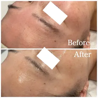 Nna 韓国肌管理のエステ・リラクイメージ