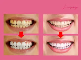 Beautyサロン noel de miのエステ・リラクイメージ