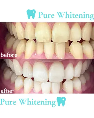 PureWhitening所属・ピュアホワイトニング 横浜店のエステ・リラクイメージ