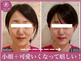 盛れる小顔矯正師 たく先生のエステ・リラクイメージ