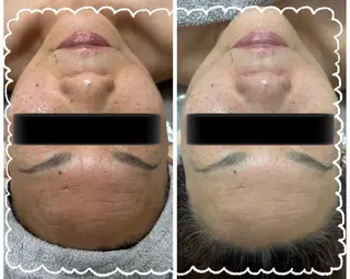 小顔美肌痩身サロン Ranのその他イメージ