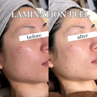 東大阪/韓国肌管理/ 痩身バスト専門店のエステ・リラクイメージ