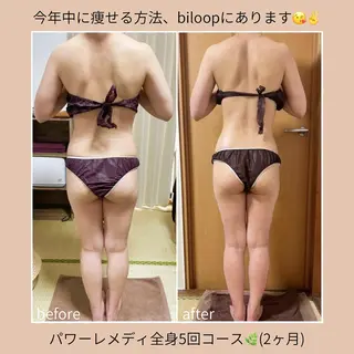 《本気痩せ×疲労改善 》  BILOOPのエステ・リラクイメージ