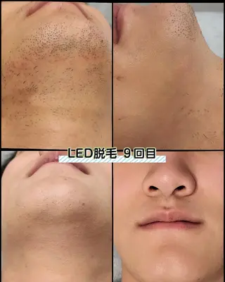 メンズ Lino SALONのエステ・リラクイメージ