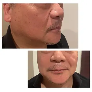 メンズ espoir-K 横浜のエステ・リラクイメージ