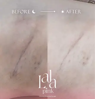 KIRAN 山﨑のエステ・リラクイメージ