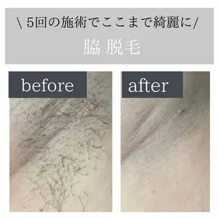 脱毛サロン Lokahiのエステ・リラクイメージ