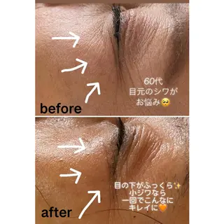 アロマ•ピーリング SalonYokoのその他イメージ