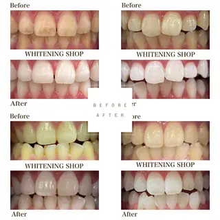 ホワイトニング ショップ伊丹店のその他イメージ