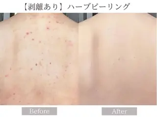 肌質改善サロン renew/ｳｴｷのエステ・リラクイメージ