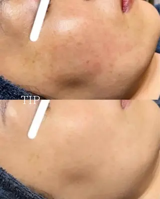 パーソナルスキンケア 🦋APRI🅿️有のエステ・リラクイメージ