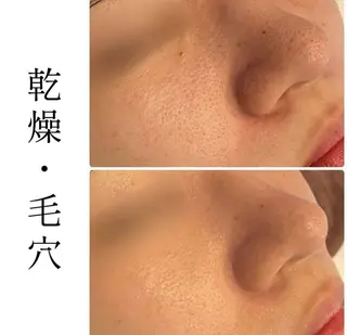 ハーブピーリング専門 BIOPLUS+川崎のエステ・リラクイメージ