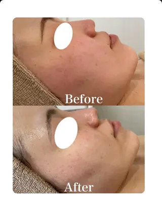 MISEL  2nd所属・主島 葉月のエステ・リラクイメージ