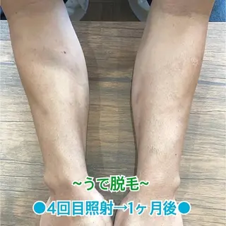 メンズ キッズ BiSTA ヒロのエステ・リラクイメージ