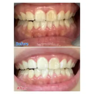 M渋谷 ホワイトニングのエステ・リラクイメージ