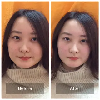 美容鍼×小顔矯正× 美容整体/小林幸司のエステ・リラクイメージ