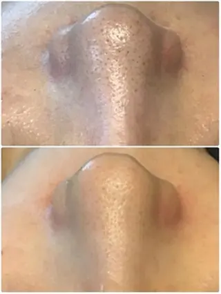 EYE LASH LAPISのエステ・リラクイメージ