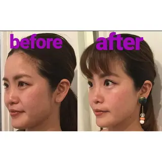 隆鼻矯正専門店ラプリ 古越のエステ・リラクイメージ