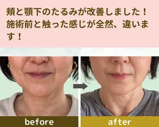 ヘイワポッド所属・小顔&ヘッドスパ/ もりもとまきみのエステ・リラクイメージ