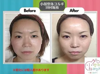 NaKid マツエク&マツパのマツエク・マツパデザイン