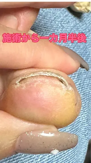 ネイル ○△□ 守口市のネイルデザイン