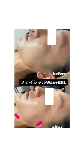 キッズ メンズ Epina 千葉店 【エピナ】のエステ・リラクイメージ