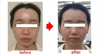 ブプラ 倉敷店のエステ・リラクイメージ