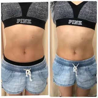 snipper横浜西口店所属・🌻こみや せいか🌻のエステ・リラクイメージ