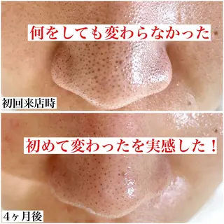 毛穴ケア専門サロン レーヌのエステ・リラクイメージ