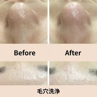 【小顔・毛穴ケア】 セラピスト　和田紋子のエステ・リラクイメージ