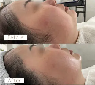 Belchic ベルシックのエステ・リラクイメージ