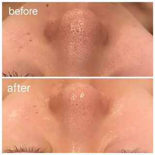 小顔×美肌デザイン✨ 理想へトータルケア◎のエステ・リラクイメージ