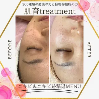 堀井 舞琳のエステ・リラクイメージ