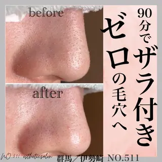 脱毛&フェイシャル NO.511のエステ・リラクイメージ