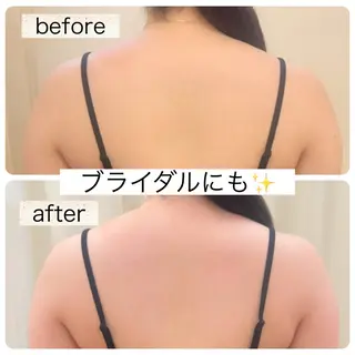 ほねつぎ一休さん 宇品店のエステ・リラクイメージ