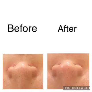 ECXIA ｴｸｼｱのエステ・リラクイメージ