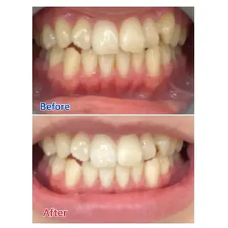 M渋谷 ホワイトニングのエステ・リラクイメージ