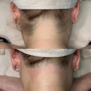 セミロング ヘアアレンジ WAX＆光脱毛 ESTHERIAのエステ・リラクイメージ