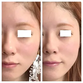 酒井 瑠未のエステ・リラクイメージ