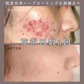 肌質改善専門サロン Bellmi/心斎橋のエステ・リラクイメージ