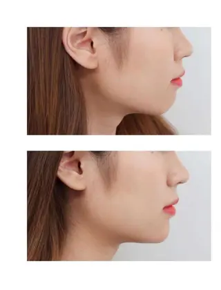 ネイル マツエク・マツパ aliaハーブ水光店 エステティシャン募集のエステ・リラクイメージ