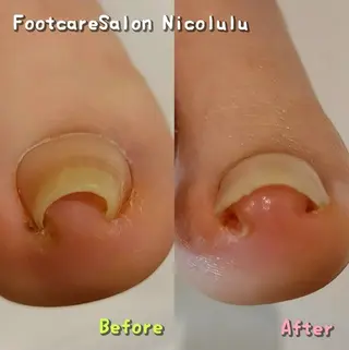 メンズ 足トラブル専門 ニコルル金沢のエステ・リラクイメージ