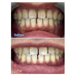 Ｍ渋谷 ホワイトニングのエステ・リラクイメージ