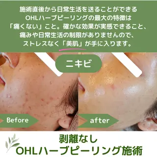 TWINKLE上尾店 Shimadaのエステ・リラクイメージ