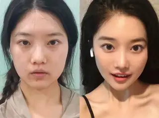 ネイル aliaハイフ&水光ジェットサロン所属・aliaハーブ水光店 エステティシャン募集のエステ・リラクイメージ